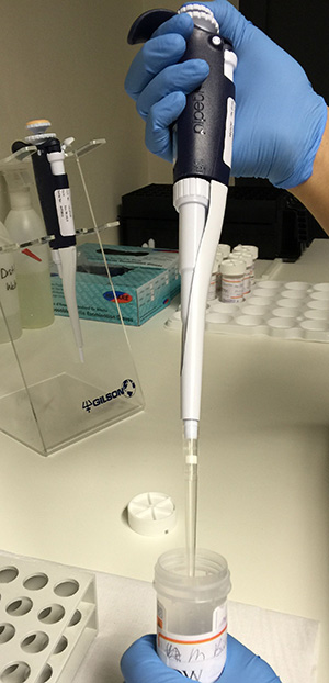pipet1-By-HPV