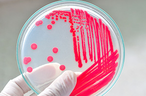 microbiology_agar_plate